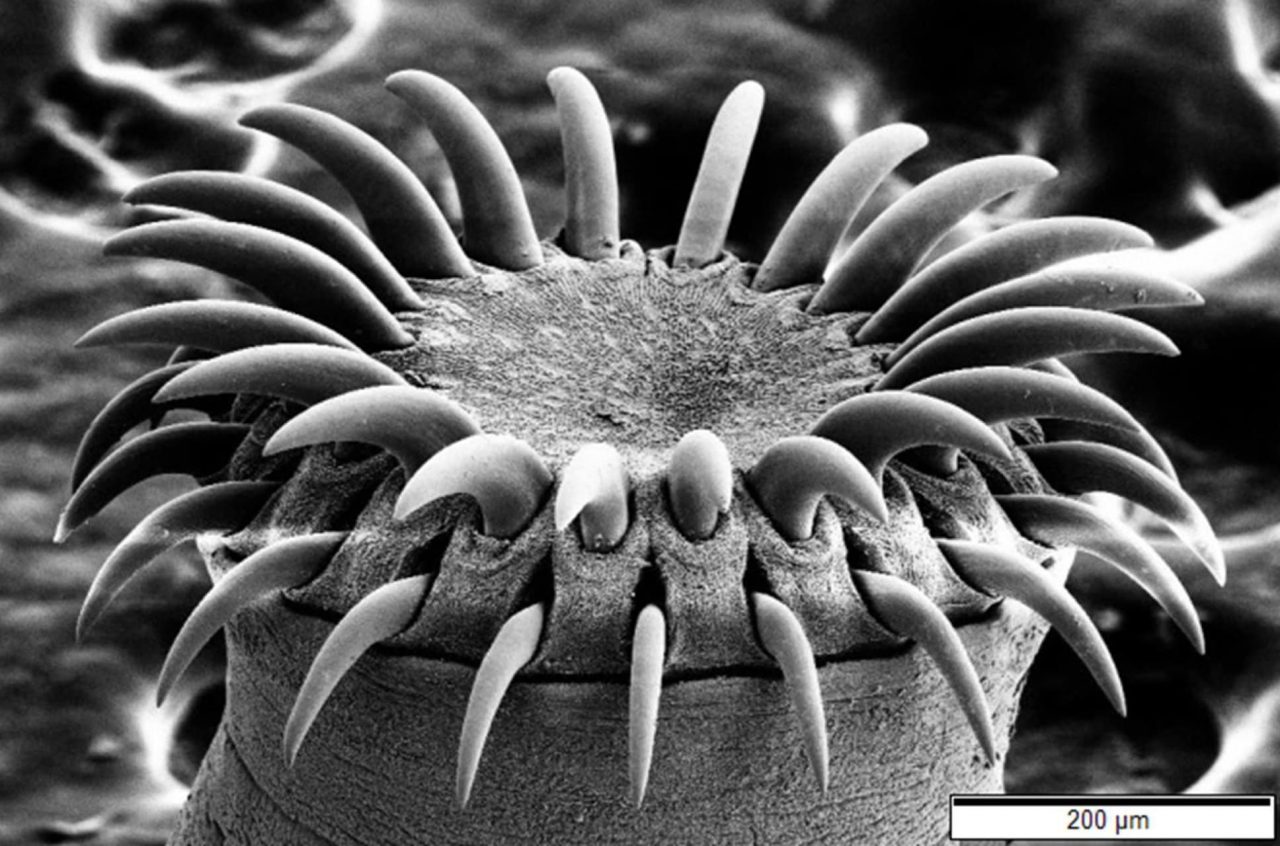 Tapeworm Head (Wikimedia Commons)