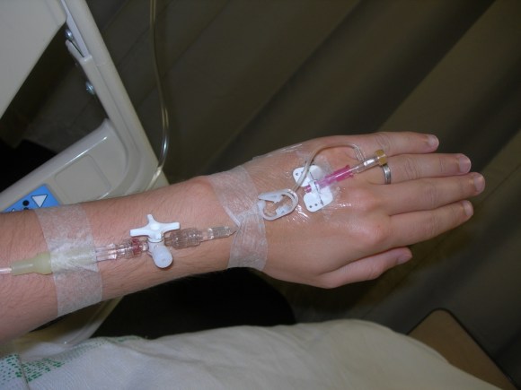 Intravenous Therapy (Wikimedia Commons)
